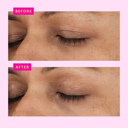 A-Shaba Complex™ - Serum pentru conturul ochilor