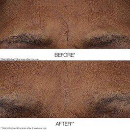 Smart Retinoid Stick - Balm anti-rid