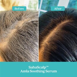 SahaScalp™ Scalp Reset Kit - Set pentru par