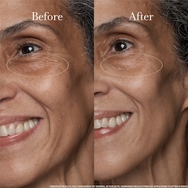 Black Tea Age Renewal Eye Concentrate – Cremă de ochi anti-îmbătrânire