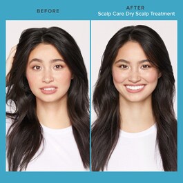 Scalp Care Dry Scalp Treatment - Tratament pentru scalp