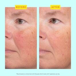 C-Luma™ Hydrabright Serum - Ser cu vitamina C