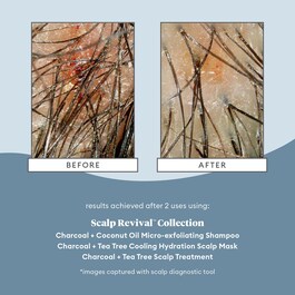 Scalp Revival Scalp Treatment - Tratament pentru scalp uscat