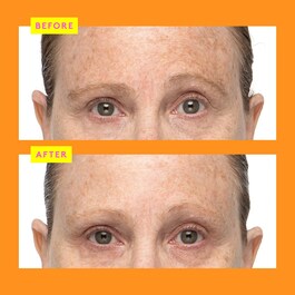C-Firma™ Fresh Day Serum  - Ser Vitamina C