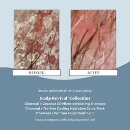 Scalp Revival Scalp Treatment - Tratament pentru scalp uscat