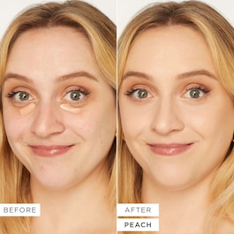 Shape Tape™ Corrector - Corector