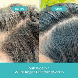 SahaScalp™ Scalp Reset Kit - Set pentru par