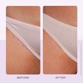 Ingrown Hair Pads - Discuri compostabile pentru peri incarnati x60