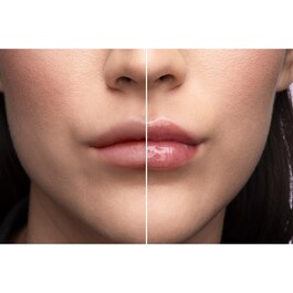 Lip Injection - Balsam de buze