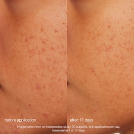 Daily Microfoliant - Exfoliant enzematic pentru fata