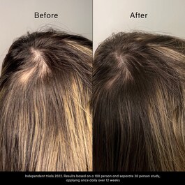 Pitta Growth Serum - Ser pentru crestere
