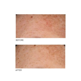 Alpha Beta® - Exfoliant formula universala