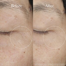Tea Elixir Skin Resilience Activating Serum - Ser activator de rezistenta