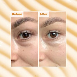 Brightening Dark Circle - Crema contur ochi impotriva cearcanelor