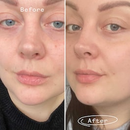 Rosehip Bioregenerate - Ulei facial cu maces