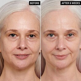 Ser anti-imbatranire cu retinol