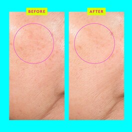 Bouncy Brightfacial™ - Mască Iluminatoare - Mască Față