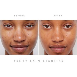 Start'r Set - Set ingrijire