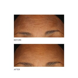 Alpha Beta® - Exfoliant formula intensa