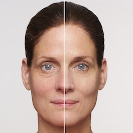 SOS Primer - Redness