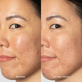 Transform Glow2OH Dark Spot Toner - Lotiune tonica pentru pete