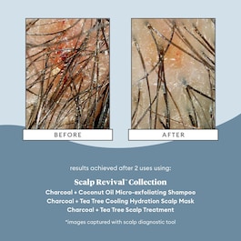 Scalp Revival Micro-Exfoliating Shampoo - Sampon micro-exfoliant