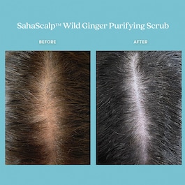 SahaScalp™ - Scrub de par cu efect purifiant
