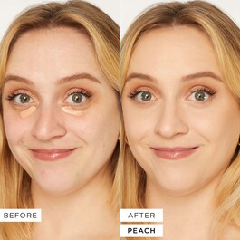 Shape Tape™ Corrector - Corector