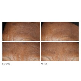 Advanced Retinol + Ferulic - Crema anti-riduri