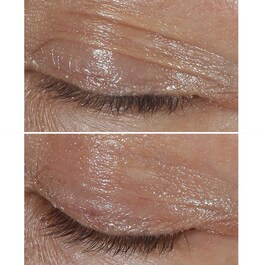 Clinique Smart Clinical Repair - Crema antirid pentru ochi