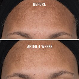 Facial Radiance Niacinamide Dark Spot Serum - Serum pete pigmentare