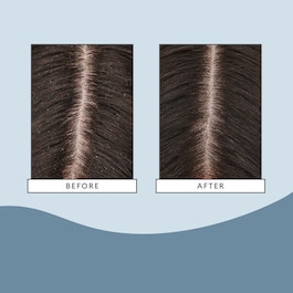 Scalp Revival Hydration - Masca hidratanta pentru par
