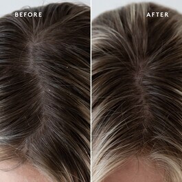 Refresh Topical Scalp Supplement - Tratament pentru scalp