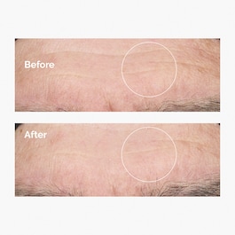 Acidul hialuronic 2% + B5 - Ser activ hidratant