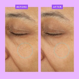 Ceramighty™ AF Eye Balm - Cremă Contur Ochi Anti-Age