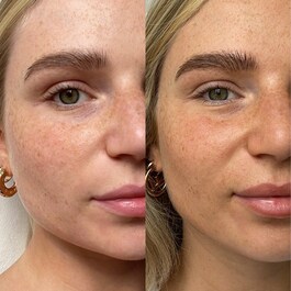 The Face Illuminating Self-Tan Drops - Serum autobronzant pentru fata