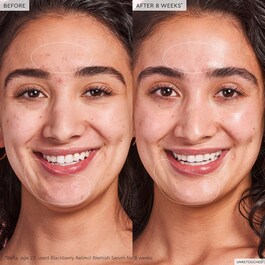 Blackberry Retinol - Ser de reinitializare