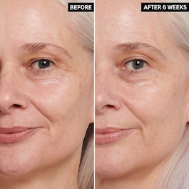 Crema anti-imbatranire pentru ochi cu retinol
