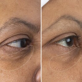 The Eye Cream - Crema pentru conturul ochilor