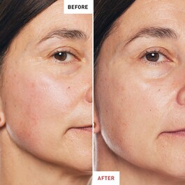 Skin Therapy - Ulei de noapte hidratant