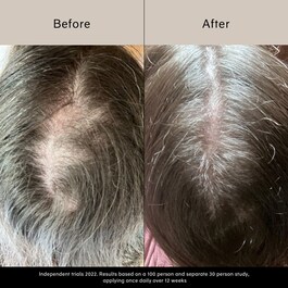 Pitta Growth Serum - Ser pentru crestere