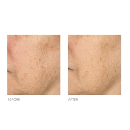 Alpha Beta® - Exfoliant formula universala