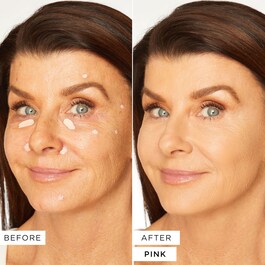 Shape Tape™ Corrector - Corector