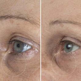 The Eye Cream Nomad - Crema pentru conturul ochilor