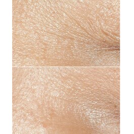 Smart Clinical Repair - Crema antirid pentru toate tipurile de piele