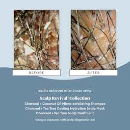 Scalp Revival Micro-Exfoliating Shampoo - Sampon micro-exfoliant