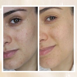 Overnight Glow Dark Spot Sleeping Cream - Crema de noapte impotriva petelor