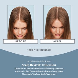 Scalp Revival Scalp Treatment - Tratament pentru scalp uscat