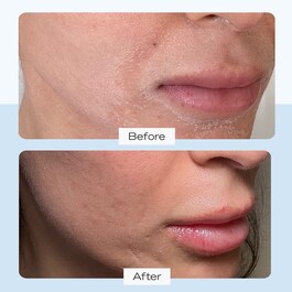 Ultra Repair Cream - Crema intens hidratanta pentru fata si corp