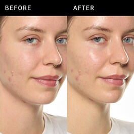Ectoin Hydro-Barrier Serum - Ser hidratant si protector